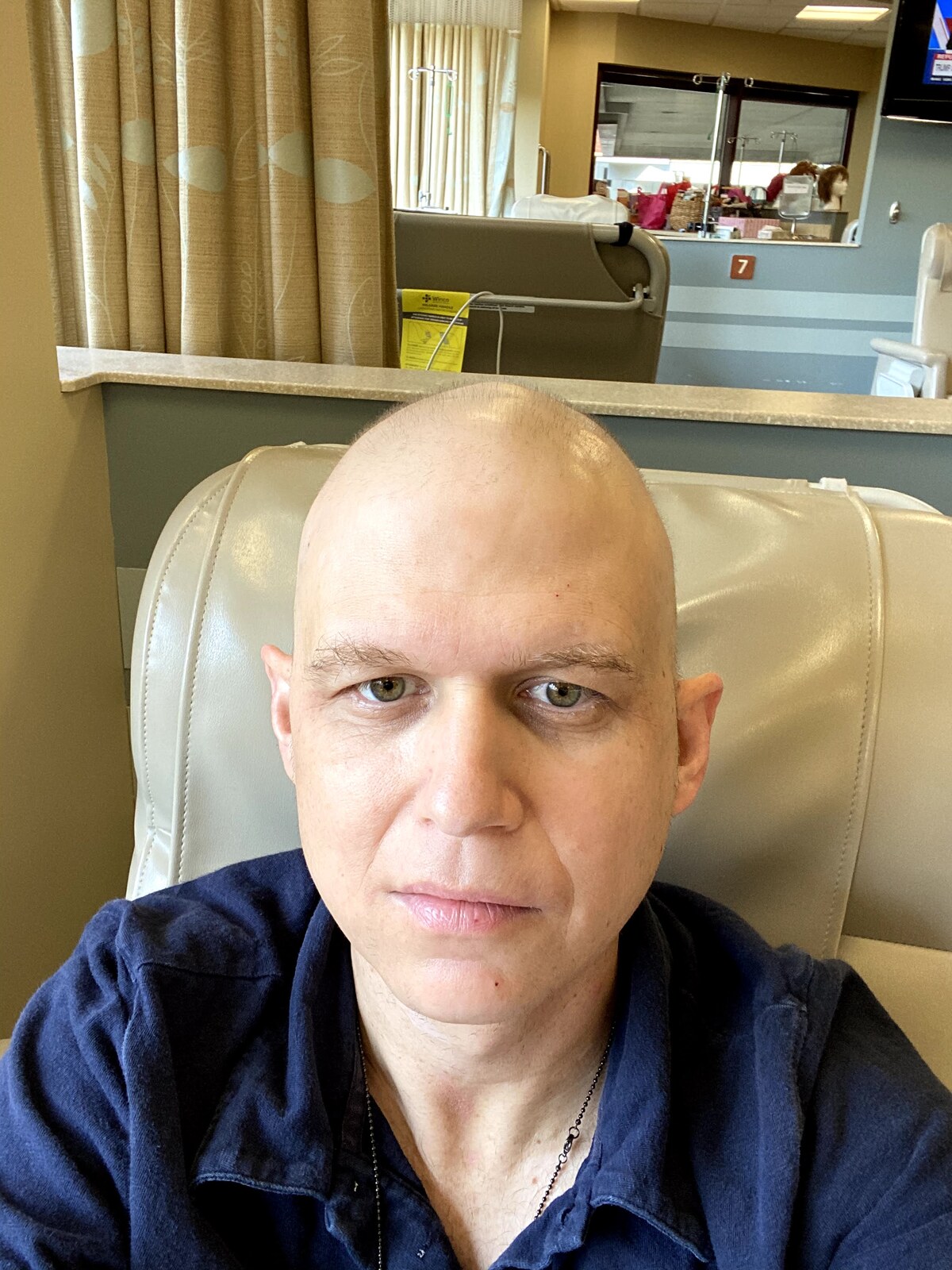 Clay Collins bald in an infusion chair, getting chemotherapy